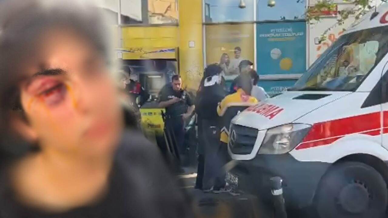 15 YAŞINDAKİ ÇOCUĞA ALÇAKÇA SALDIRDILAR, OLAY YERİNDEN KAÇTILAR…