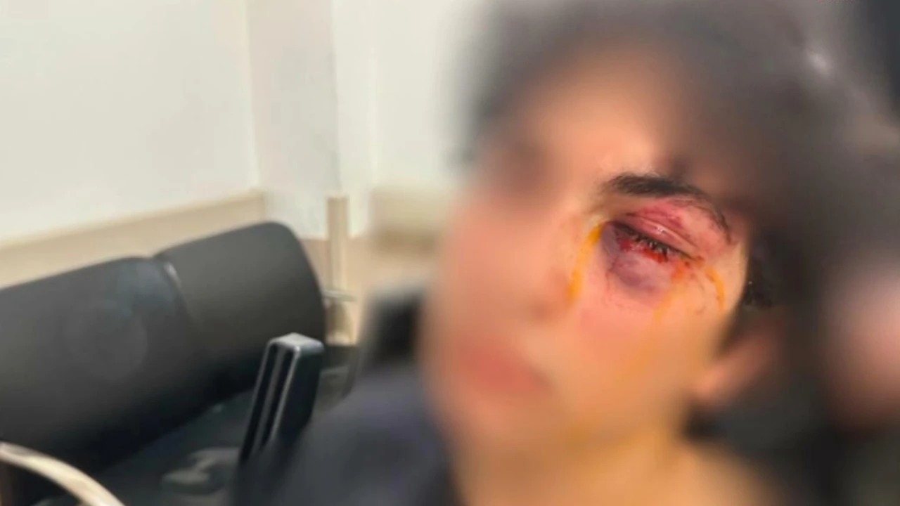 CHP STANDINDA 15 YAŞINDAKİ ÇOCUĞU HASTANELİK EDEN ŞÜPHELİYE TUTUKLAMA…